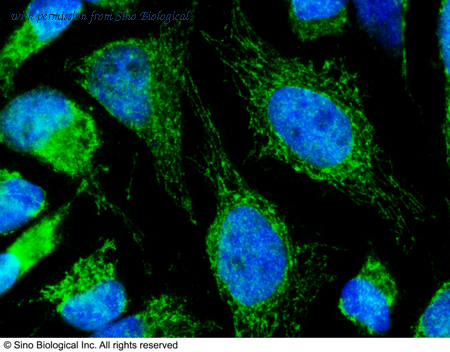 Sino Biological 11640-R212 image 1
