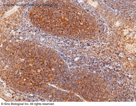 Sino Biological 12275-MM01 image 1