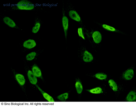 Sino Biological 101116-T46 image 1