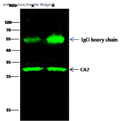 Sino Biological 10478-RP02 image 1