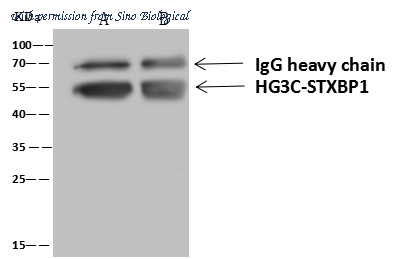 Sino Biological 11751-T20 image 1