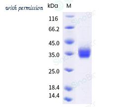 Sino Biological 10084-H08H-UE image 1