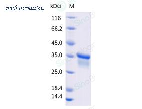 Sino Biological 10102-H49H-B image 1