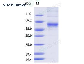 Sino Biological 212-SFTSV0050 image 1