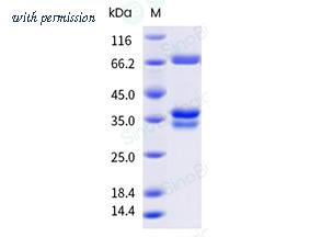Sino Biological 91043-C49H-B image 1