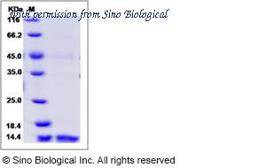 Sino Biological 10215-HNCH image 1