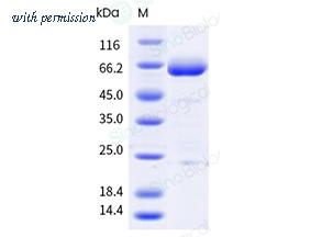 Sino Biological 10904-H49H-B image 1