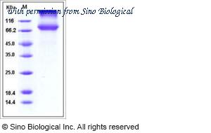 Sino Biological 11059-V08H1 image 1