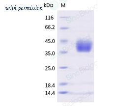 Sino Biological 29849-H08H image 1