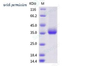 Sino Biological 40592-V08H58 image 1