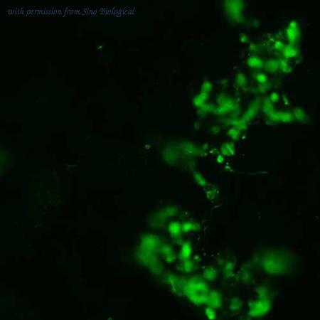 Sino Biological HG13944-CF image 1