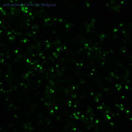 Sino Biological HG15532-ACG image 1