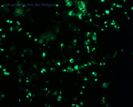 Sino Biological HG10391-ACG image 1