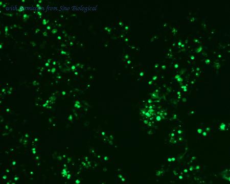 Sino Biological HG10703-ACG image 1