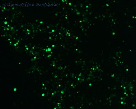 Sino Biological HG11590-ACG image 1