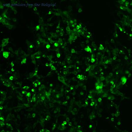 Sino Biological HG10113-ACG image 1