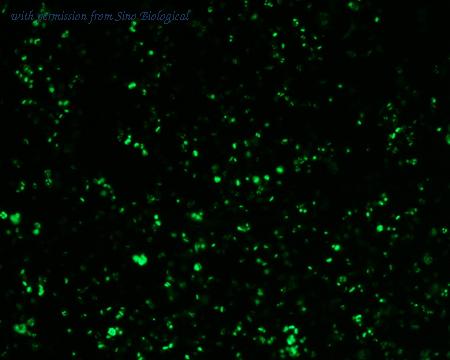 Sino Biological HG11279-ANG image 1