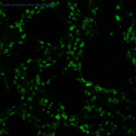 Sino Biological HG12317-CF image 1
