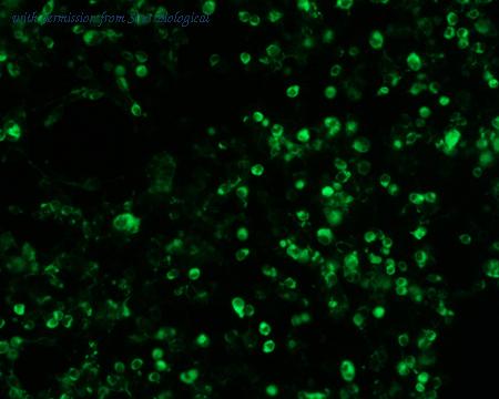 Sino Biological HG10256-ACG image 1