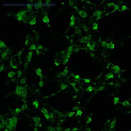 Sino Biological HG10346-CF image 1