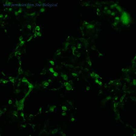 Sino Biological HG10826-CF image 1