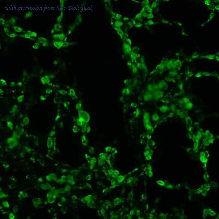 Sino Biological HG11075-CF image 1