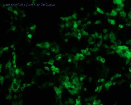 Sino Biological HG11381-ACG image 1