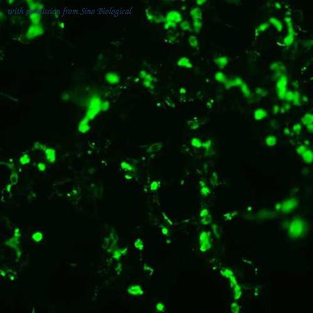 Sino Biological HG11415-CF image 1