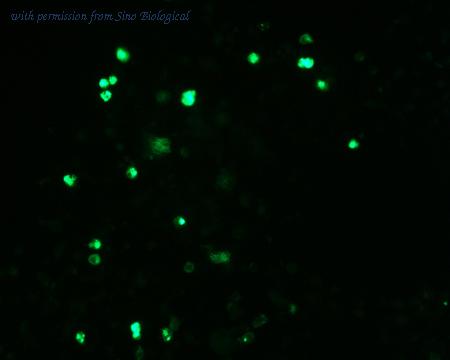 Sino Biological HG11848-ACG image 1