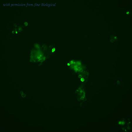 Sino Biological RG80098-ACG image 1