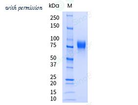 Sino Biological 10161-H08H-UE image 1