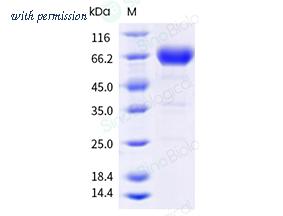 Sino Biological 10165-H41H-B image 1