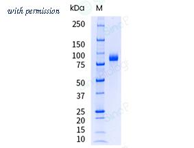 Sino Biological 10171-H02H-UE image 1