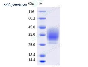 Sino Biological 10186-H49H-B image 1