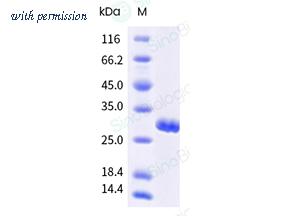 Sino Biological 10284-HNCE image 1