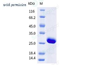 Sino Biological 10368-H56E-B image 1