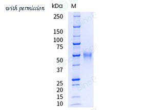 Sino Biological 10417-H08H1-UE image 1