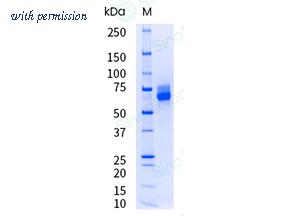 Sino Biological 10440-H08H-UE image 1