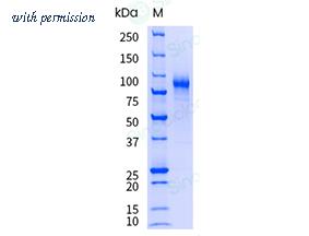 Sino Biological 10445-H08H-UE image 1