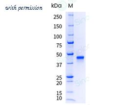 Sino Biological 10645-H01H-UE image 1