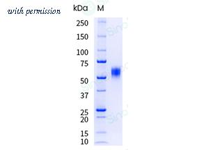 Sino Biological 10730-H08H-UE image 1