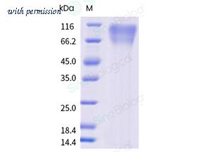 Sino Biological 11051-H49H-B image 1
