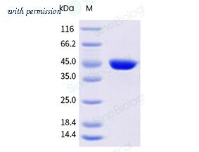 Sino Biological 11227-H49H-B image 1