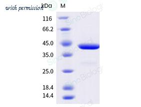 Sino Biological 11227-HNAH image 1