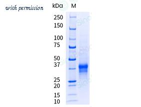 Sino Biological 11241-H08H-UE image 1