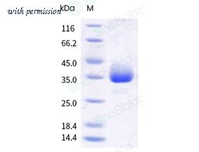 Sino Biological 11456-HNAH image 1
