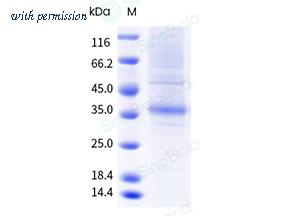 Sino Biological 12504-H18H-NA image 1