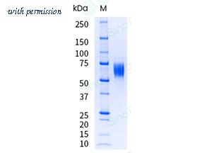 Sino Biological 16224-H08H-UE image 1