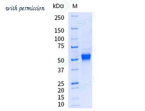 Sino Biological 17049-H15H-UE image 1