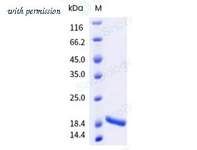 Sino Biological 40573-V49E-B image 1